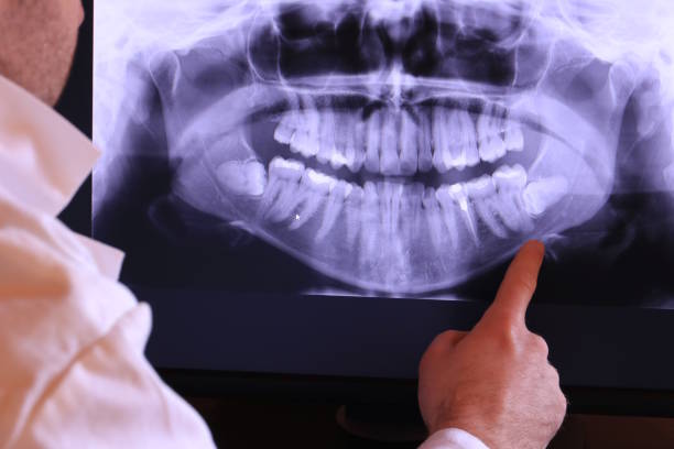 Best Walk-In Emergency Dentist in Orland, CA
